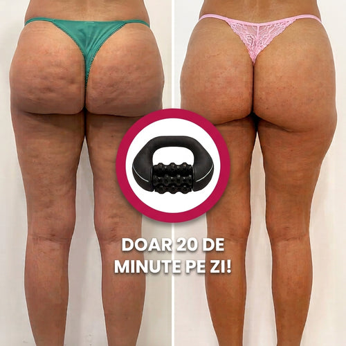 Rola de Masaj Electrica AntiCelulita HealTwist™